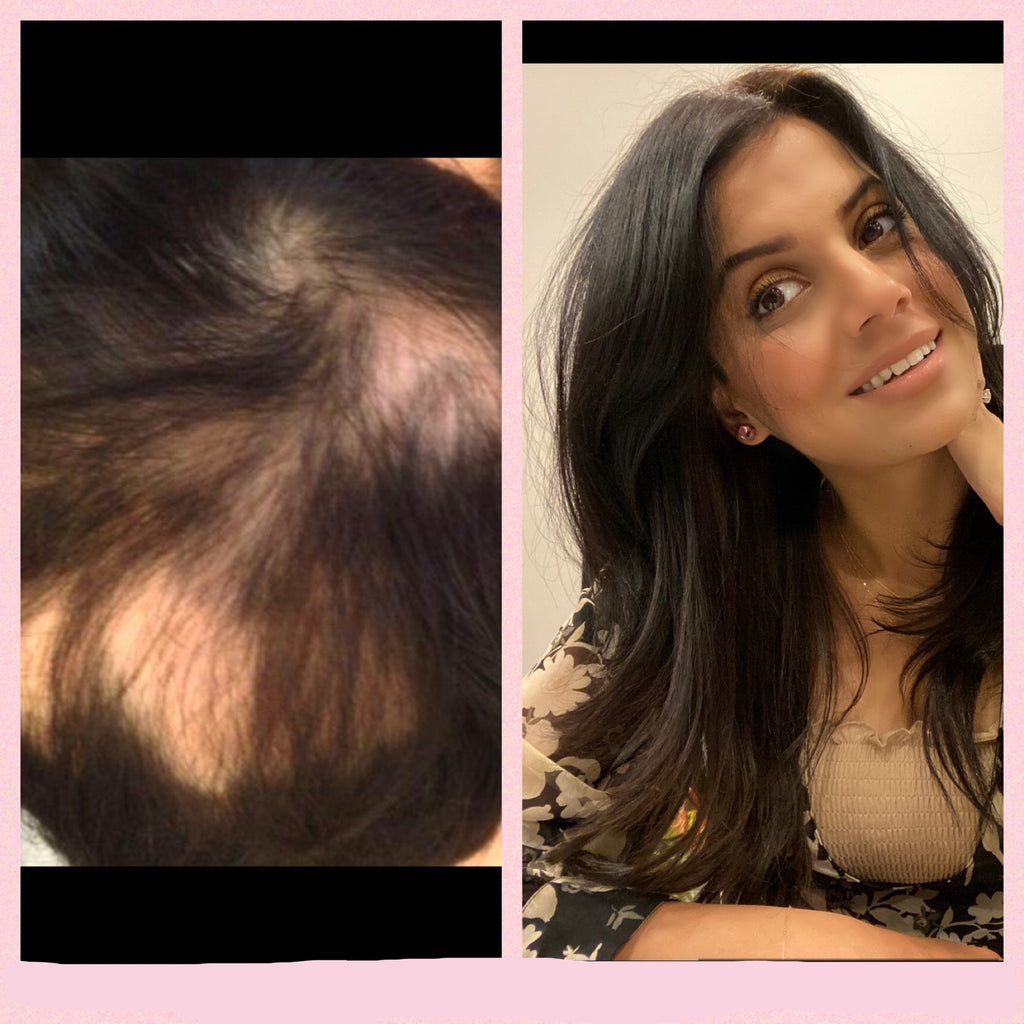 Our Story Amazing Hair Saviour